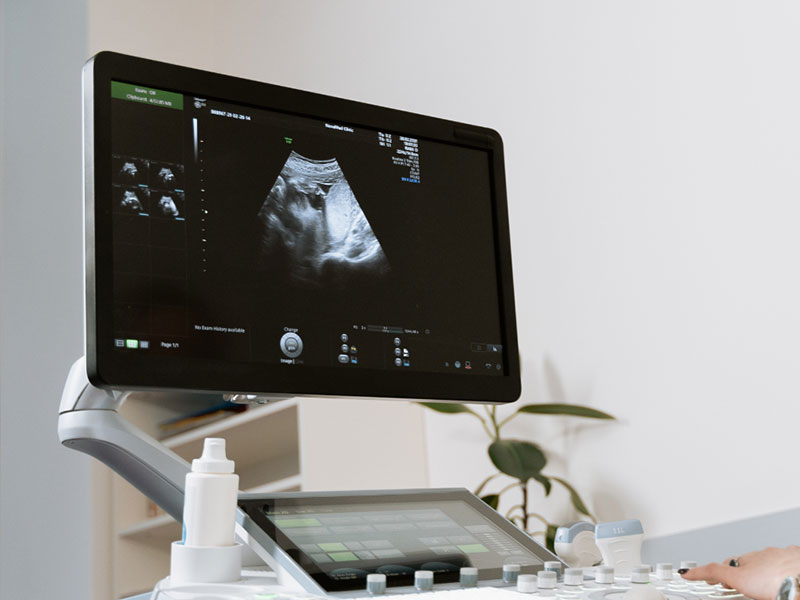 ultrasound machine at a pregnancy resource center